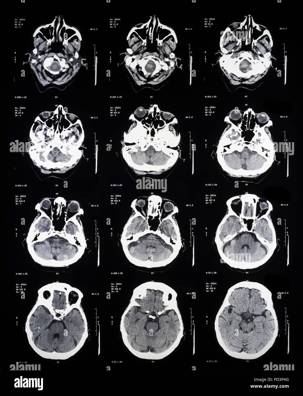 Reihenfolge der horizontale Abschnitte eines weiblichen menschlichen Gehirn, MRI-Scans, Magnetresonanztomographie, Stockfoto