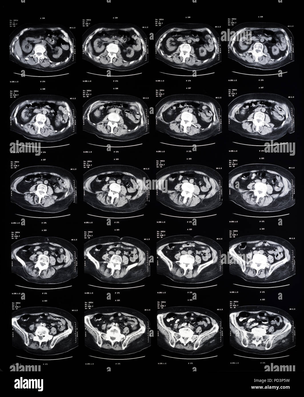 Reihenfolge der horizontale Abschnitte eines weiblichen menschlichen Gehirn, MRI-Scans, Magnetresonanztomographie, Stockfoto