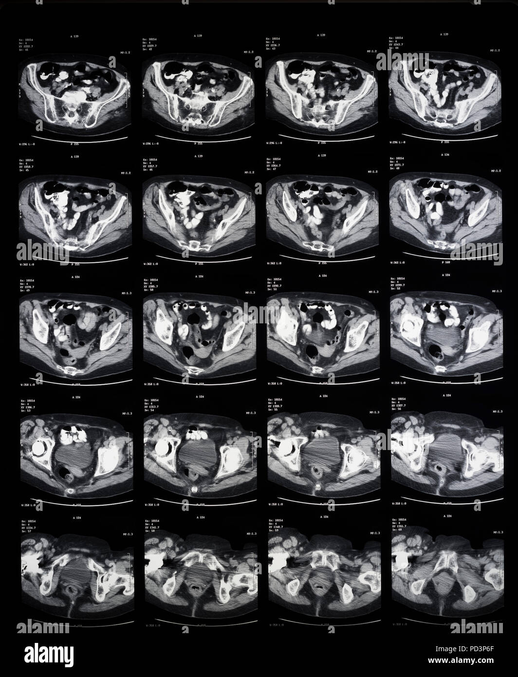 Reihenfolge der horizontale Abschnitte eines weiblichen menschlichen Gehirn, MRI-Scans, Magnetresonanztomographie, Stockfoto