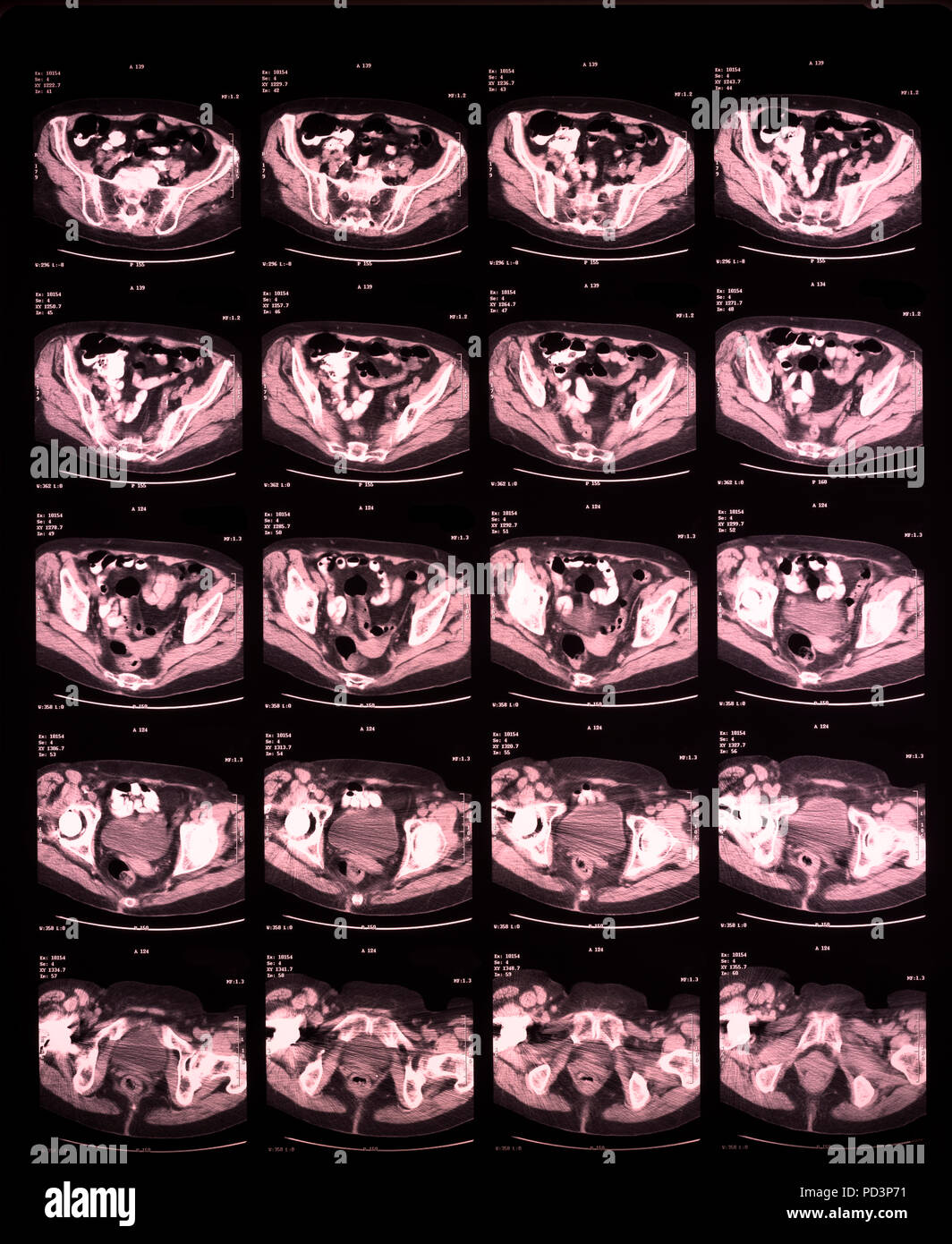 Reihenfolge der horizontale Abschnitte eines weiblichen menschlichen Gehirn, MRI-Scans, Magnetresonanztomographie, Stockfoto