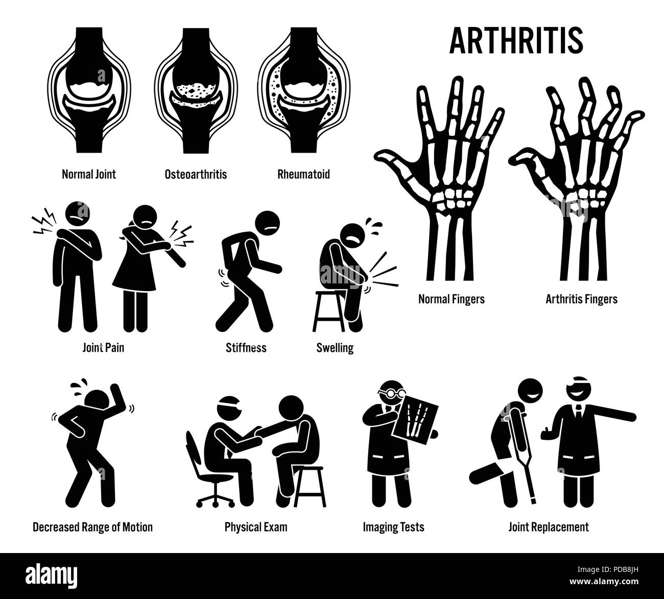 Arthritis, Gelenkschmerzen und gemeinsame Krankheit Symbole. Piktogramme zeigen Arthritis Anzeichen, Symptome, Diagnose und Behandlung. Stock Vektor