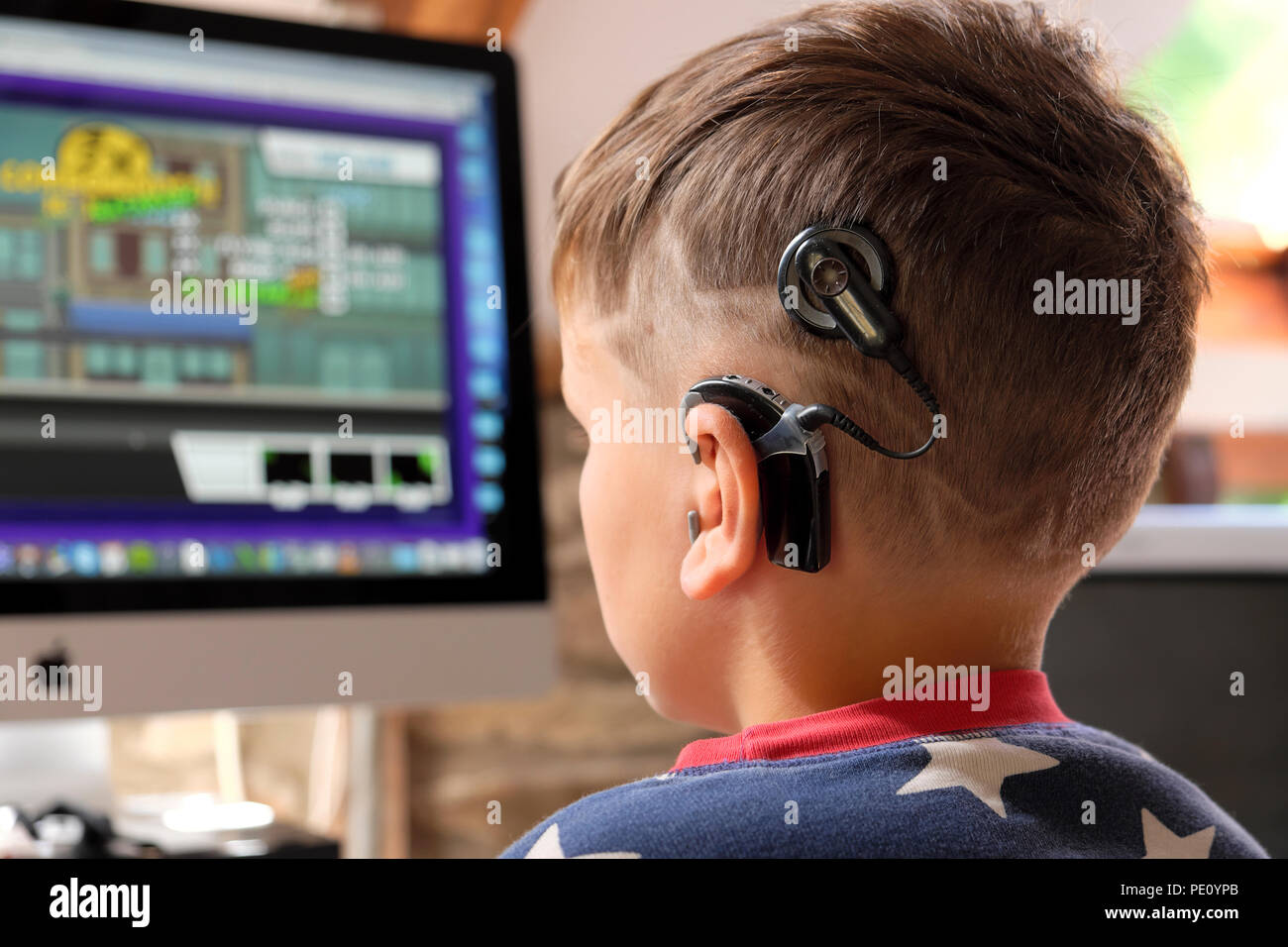 Rückansicht eines Jungen mit Cochlea-Implantat mit digitaler Technologie, der einen Bildschirm betrachtet, der ein Computerspiel zu Hause im Haus UK SPIELT KATHY DEWITT Stockfoto