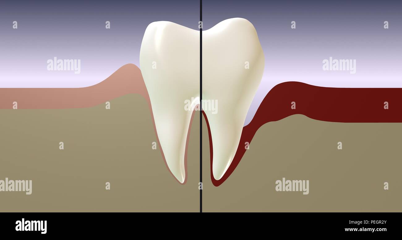 Zahn. Zahnheilkunde und zahnärztliche Versorgung. 3D Rendering Illustration. Stockfoto