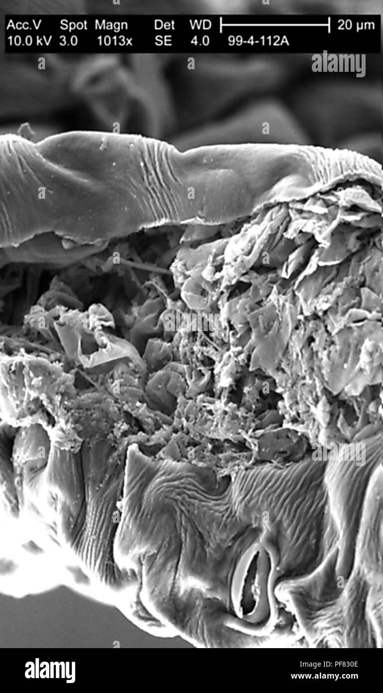 Texturierte Oberfläche an der Verletzung Aufstellungsort auf einem gehackte Petersilie Blatt in den 1013x vergrößert dargestellt Rasterelektronenmikroskopische (SEM) Bild, 1999. Mit freundlicher Seuchenkontrollzentren (CDC)/Janice Haney Carr. () Stockfoto
