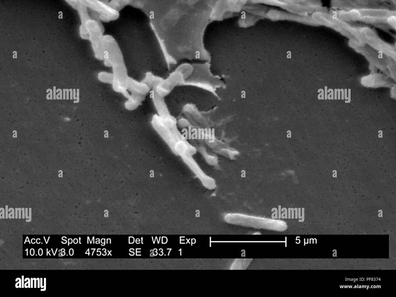 Gram-positive Bakterien Clostridium difficile in der Stuhlprobe Schliffbild film, 2004 aufgedeckt. Mit freundlicher Seuchenkontrollzentren (CDC)/Lois S. Wiggs. () Stockfoto