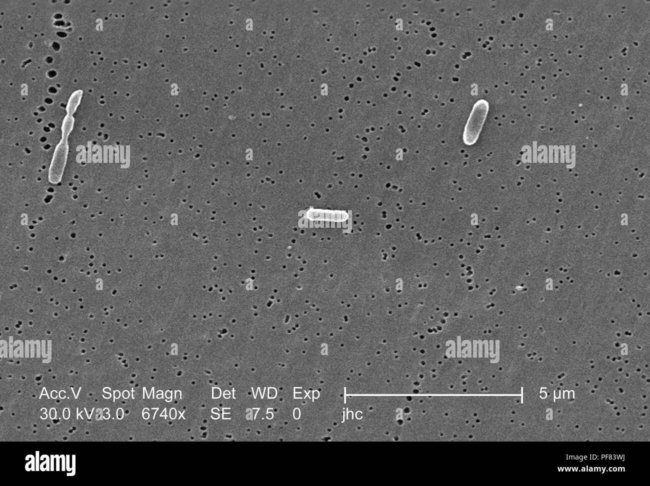 Drei Ralstonia mannitolilytica Bakterien im 6740 x vergrößert Rasterelektronenmikroskopische (SEM) Bild 2006 aufgedeckt. Mit freundlicher Seuchenkontrollzentren (CDC)/Judith Noble-Wang, Ph.D. () Stockfoto