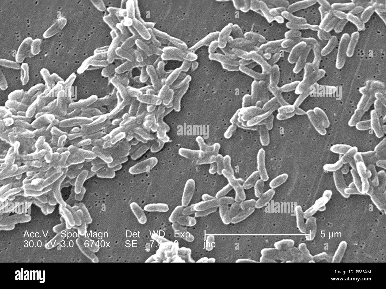 Gruppierung von Ralstonia mannitolilytica Bakterien im 6740 x offenbart vergrößerte Rasterelektronenmikroskopische (SEM) Bild, 2006. Mit freundlicher Seuchenkontrollzentren (CDC)/Judith Noble-Wang, Ph.D. () Stockfoto