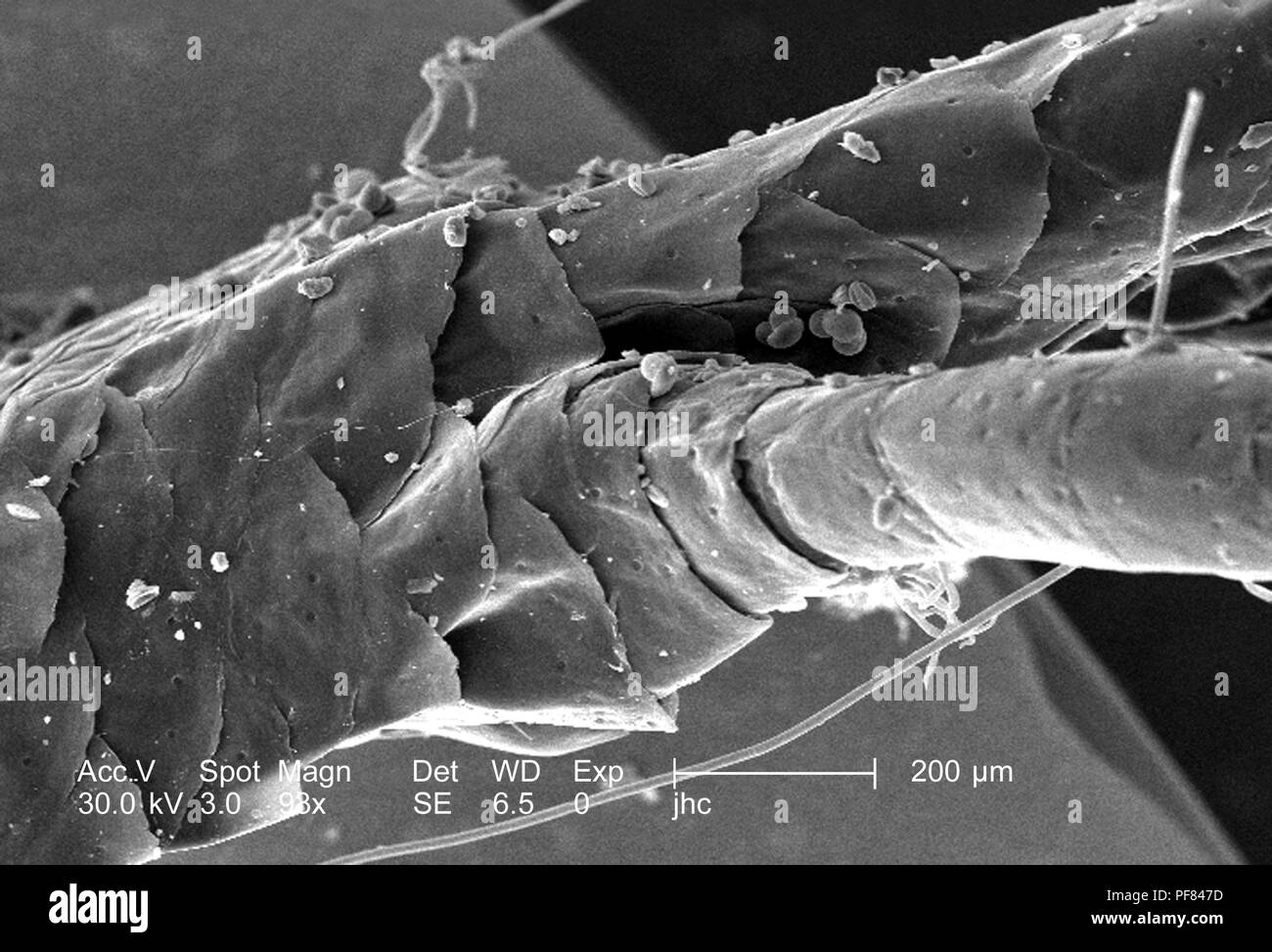 Morphologische Merkmale eines verstorbenen Eidechse Fuß in Decatur, Georgia, 98 x ergab vergrößerte Rasterelektronenmikroskopische (SEM) Bild, 2006. Mit freundlicher Seuchenkontrollzentren (CDC)/William L. Nicholson, Ph.D. Cal Welbourn, Ph.D., Gary R. Mullen. () Stockfoto