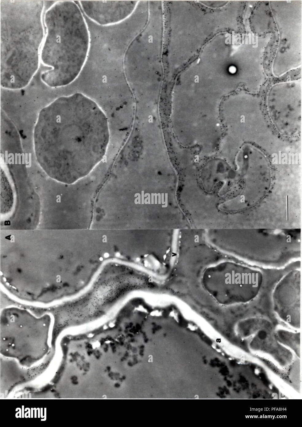 Entwicklung Von Cytochemical Methoden Fur Die Untersuchung Der Ascospore Wand Biogenese Und Reifung Ascomyceten Ascosporen Pilze 106 Bitte Beachten Sie Dass Diese Bilder Sind Von Der Gescannten Seite Bilder Die Digital