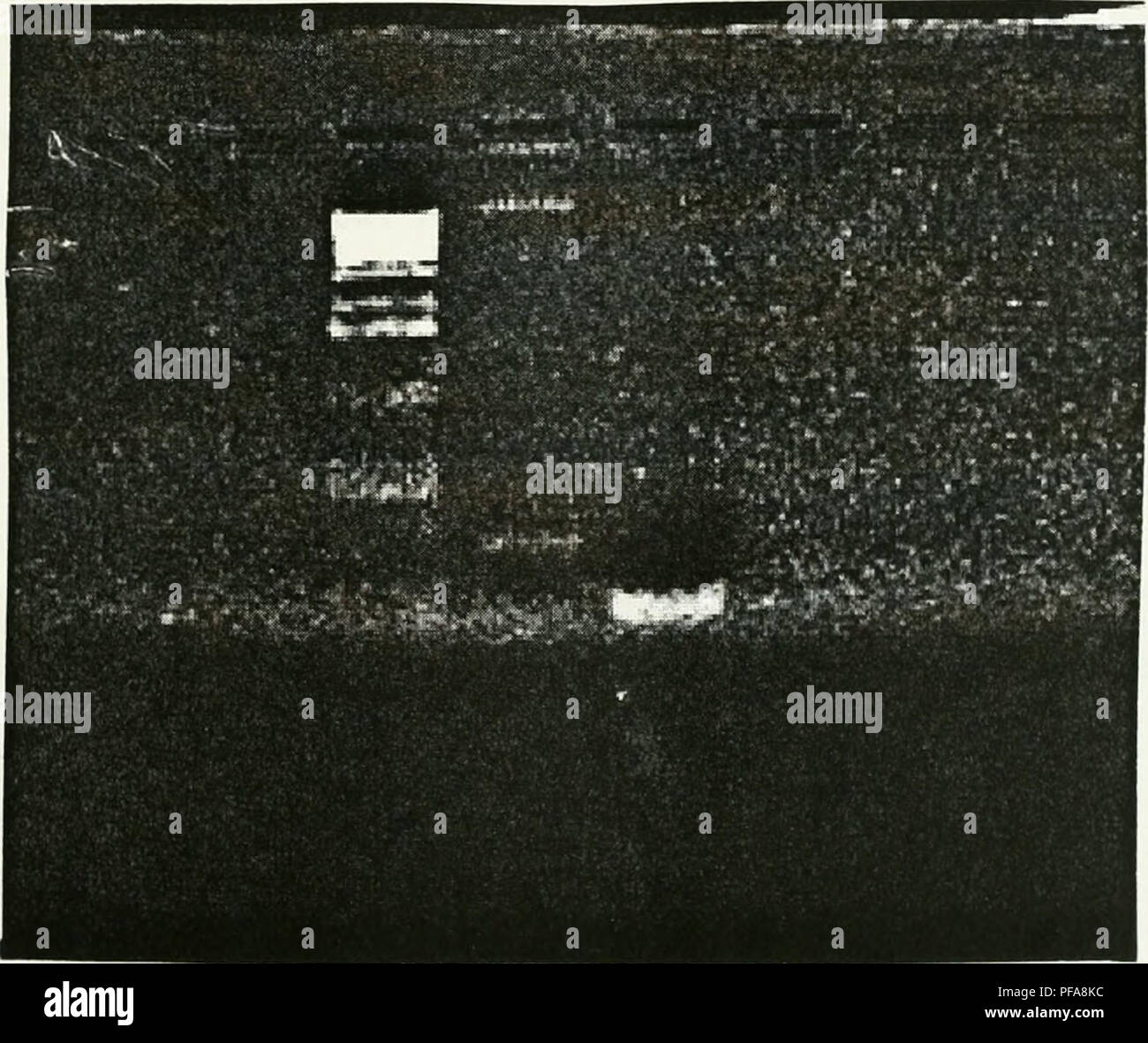 . Die Entwicklung einer cosmid Karte von Chromosom 12p13. Sweet Briar College; Chromosomen. Abbildung 18. 1,5% Agarose-Gel-Elektrophorese einer digoxigenin Kennzeichnung PCR-Verfahren mit Vorwärts- und Rückwärtsgang Grundierungen für STS-D12 S950. Spur 3 enthält 0,5 | ag 1 KB Leiter und Spur 4 enthält K562 Bezeichnung DNA. Ein schwaches Band sichtbar ist in der Spur 4 bei ca. 396 oder 344 Basen entsprechend der Bezeichnung STS-Marker. FiGURn 19. 1,5% Agarose-Gel-Elektrophorese von Digoxigenin markierten K562 DNA mit Vorwärts- und Rückwärtsgang Primer für D12 und D12S 1987 S 1914. Spur 3 enthält 0,5 ng von 1 KB Leiter. Lane 4 hat K562DN Stockfoto
