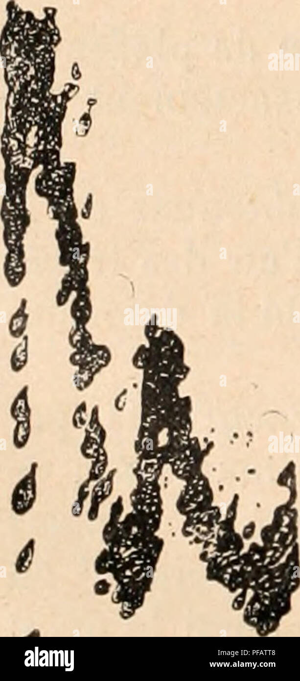 . Wörterbuch de Physiologie. Physiologie. Abb. 113. - Einrichtung "Beendigung de deux points synchrones. peut, grÃ¢ce Ã des procÃ©Dekor s SPÖ © ciaux, holen Sie Projektion le tracÃ© au moment mÃªme oÃ¹ Il est obtenu. III AUTOGRAPHIE PROPREMENT DITE. Un mouvement peut Ãªtre enregistrÃ© directement sans l'intermÃ©diaire d'une Plume inscrivante, sur une surface animÃ©e d'un Mouvement de Übersetzung. C'est ainsi qu'on peut enregistrer les Mouvements des Ailes d'un Insecte. Il suffit d'approchre La Pointe d'une aile d'un Insecte, Tenu herum À la Main avec Les on AKU ou à l'aide d'une Pince, d'une Surface de enduite Stockfoto