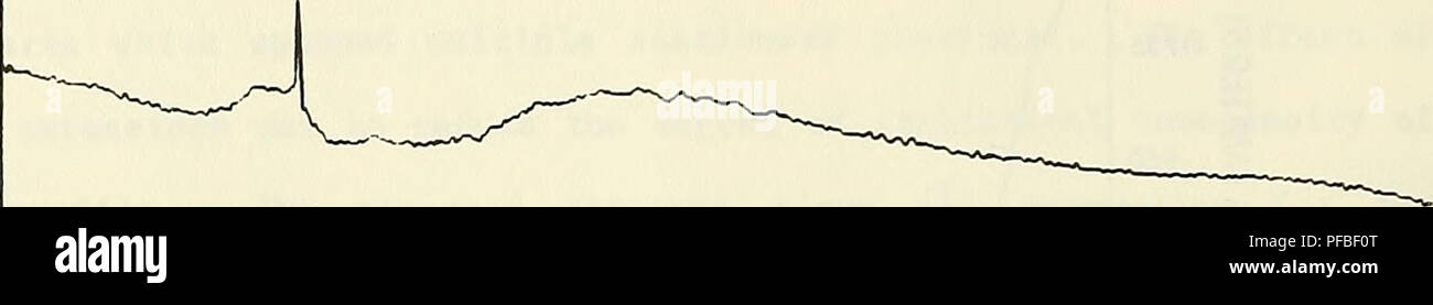 . Beschreibung, Analyse und Vorhersage von Meeresboden Unebenheiten mit spektrale Modelle. Ocean Bottom; Submarine Geologie. -100N -50 UJ 1. UJ 5 0 I * - UJ 50 O. 100 10'-I^10 Â°G 10-â Sio -^^ 10 -" - ICH HABE EINEN UJ N 5 10 10-5 ^. 10 - 10 - 16 24 32 40 Distanz (km) 48 56. Bitte beachten Sie, dass diese Bilder sind von der gescannten Seite Bilder, die digital für die Lesbarkeit verbessert haben mögen - Färbung und Aussehen dieser Abbildungen können nicht perfekt dem Original ähneln. extrahiert. Fox, Christopher Gen; in den Vereinigten Staaten. Naval ozeanographische Büro. Bay St. Louis, Fräulein: Naval Ozeanographische Stockfoto