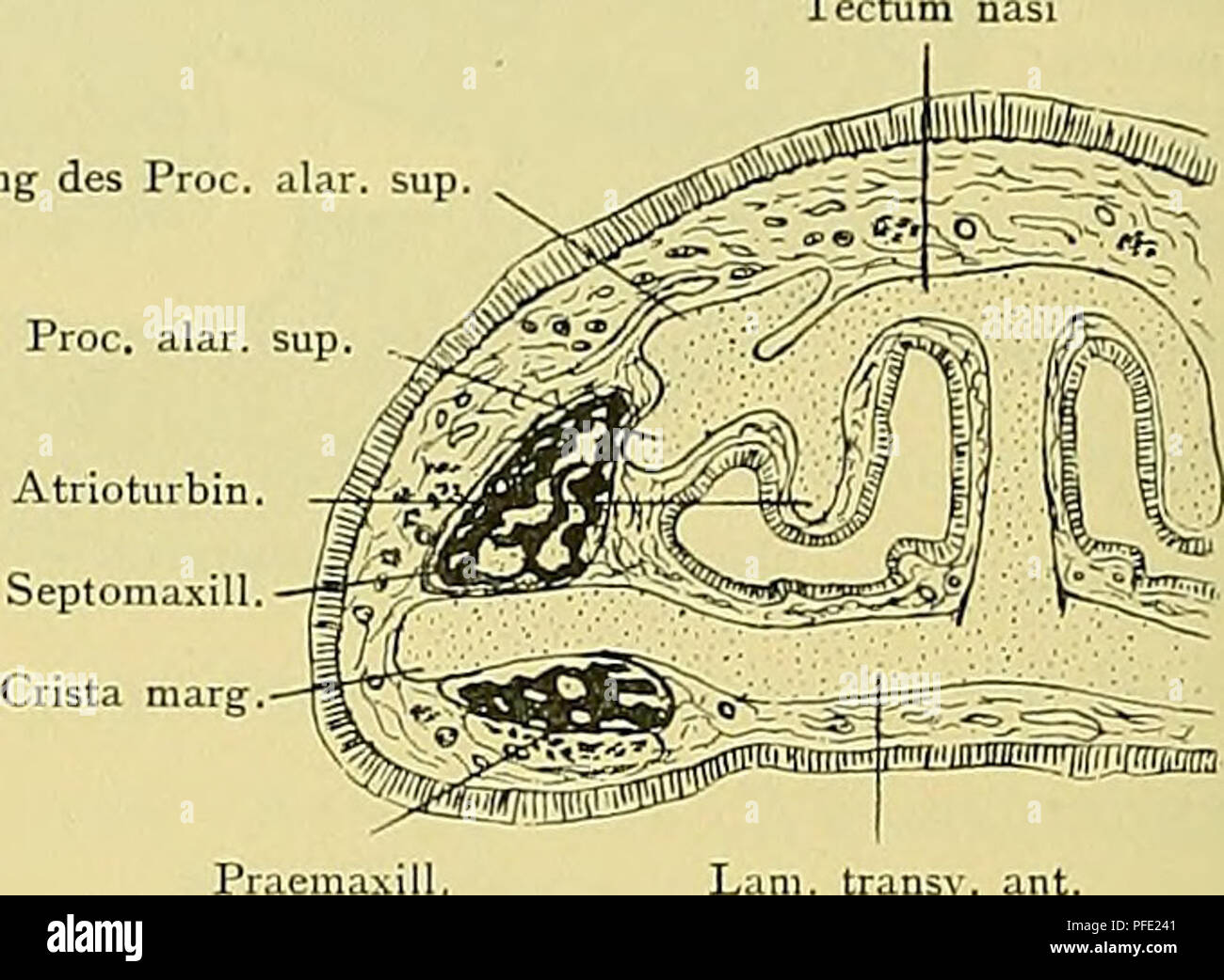 . Denkschriften der Medicinisch-Naturwissenschaftlichen Gesellschaft zu Jena. Verdickung des Pro. Abb. 52. Stadion 51a, Objecttr. I, Bd. 6, Schnitt 1. Vergr. 13:1. Lamina transversalis anterior, Crista Marginalis. Mitte der Fenestra narina. Abb. 53. Stadion 51a, Objecttr. I, Bd. 5, Schnitt 6. Vergr. 13:1. Vorderer Theil der Fenestra narina. Processus alaris Superior mit dorsaler Verdickung. Atrioturbinale. Die soeben geschilderten Verhältnisse des Ethmoidalskeletes in Stadion 51a schliessen sich sterben Befunde eine, sterben von W. N. Parker (1894), sowie von J.T. Wilson (1901) ein beuteljunge Stockfoto