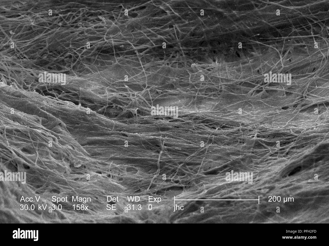 Ultrastrukturforschung Details auf der Oberfläche eines nicht identifizierten Wespen Nest in Decatur, Georgia, in der 158 ergab x vergrößert Rasterelektronenmikroskopische (SEM) Bild, 2006. Mit freundlicher Seuchenkontrollzentren (CDC). () Stockfoto