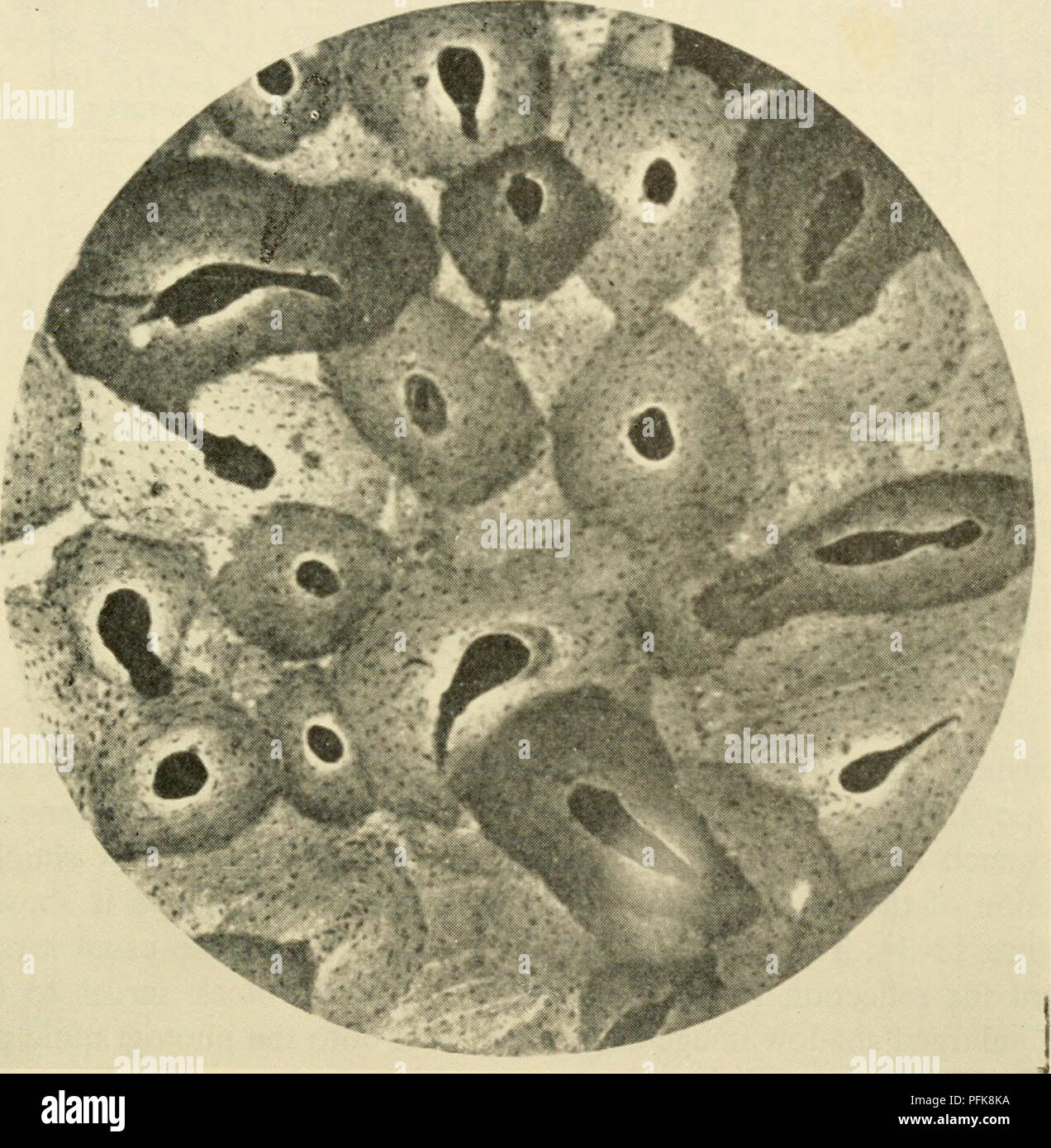 . Zytologie. Zytologie. X-Strahlen. Photograhic Emulsionen Suspensionen von Silberhalogenid Kristalle in Gelatine. Als Folge der Einwirkung von Licht oder ionisierender Strahlung (z.b. Röntgen), die Silver bromide Kristalle sind durch die fotografische Entwicklung reduziert zu metallischem Silber (schwarz). Die daraus resultierenden negativen können untersucht werden und rephotographed bei höheren Vergrößerungen durch die konventionelle optische Mikroskop (Abbildung 11-31). In der Projektion microradiography, die fotografischen Film ist zurück von Kontakt mit der Probe verschoben. Dies führt zu einer Erweiterung der Schatten produziert durch die Röntgenstrahlen, die durch Stockfoto