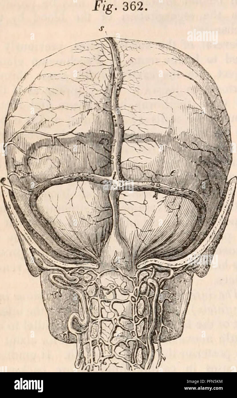. Die cyclopaedia von Anatomie und Physiologie. Anatomie, Physiologie, Zoologie. 632 NERVENSYSTEM. (Nervöse Zentren. Die MENINGEN.) dinal Sinus oben; eine für die geraden Sinus vor; zwei für die seitenbuchten auf jeder Seite und zwei für den okzipitalen Nebenhöhlen inferiorly (Jig. 362, 0. Hinteren Teil des Schädels entfernt, der Dura mater und die Superior längs zu erzeigen, die seitliche Nebenhöhlen, die ivith torcular Herophili. e, seitliche Sinus; t, torcular Herophili; s, Superior longitudinal Sinus. Seitenbuchten. - Von jeder Seite des Con-Flux der Nasennebenhöhlen, es geht in einem einige-w Stockfoto