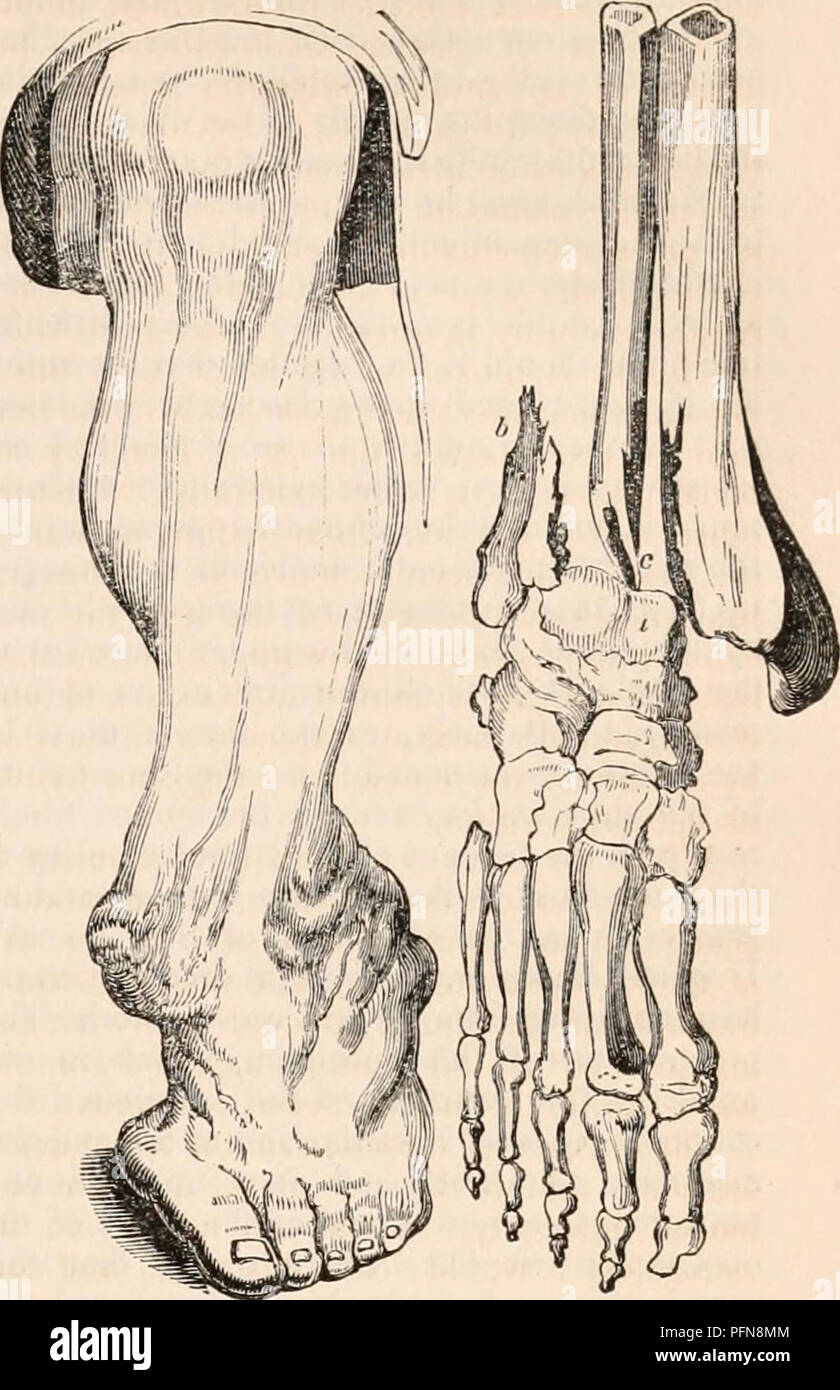 . Die cyclopaedia von Anatomie und Physiologie. Anatomie, Physiologie