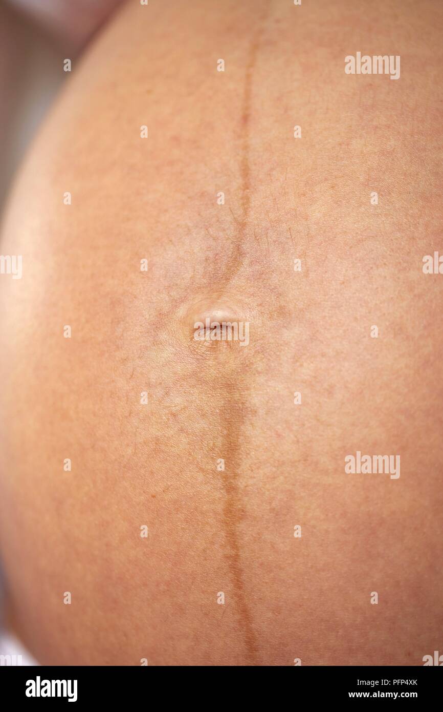 Linea Nigra Stockfotos Linea Nigra Bilder Alamy