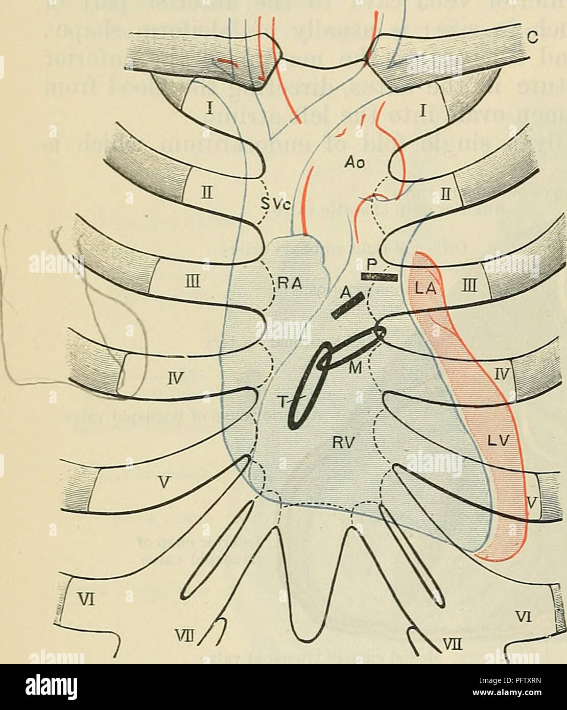 . Cunninghams Lehrbuch der Anatomie. Anatomie. 876 Das GEFÄSSSYSTEM. Ein Teil der vorderen Begrenzung ist die Trio-ventrikulärer Aperture. Letzteres ist eine ovale Form; die lange Achse' schräg antero-posterior, und von links nach rechts und ist in der Lage, die Zulassung von zwei Fingern. Es wird durch ein Ventil gebildet von zwei großen cusps bewacht, und wird als die Mitralklappe Drossel bekannt. Ventriculi. - Die ventrikuläre Teil des Herzens ist konisch und etwas abgeflacht. Der Basis, nach oben gerichtet, und Posterior, ist teilweise kontinuierlich mit der atrialen Teil und teilweise frei. Es ist perforiert, durch vier Öffnungen, Stockfoto