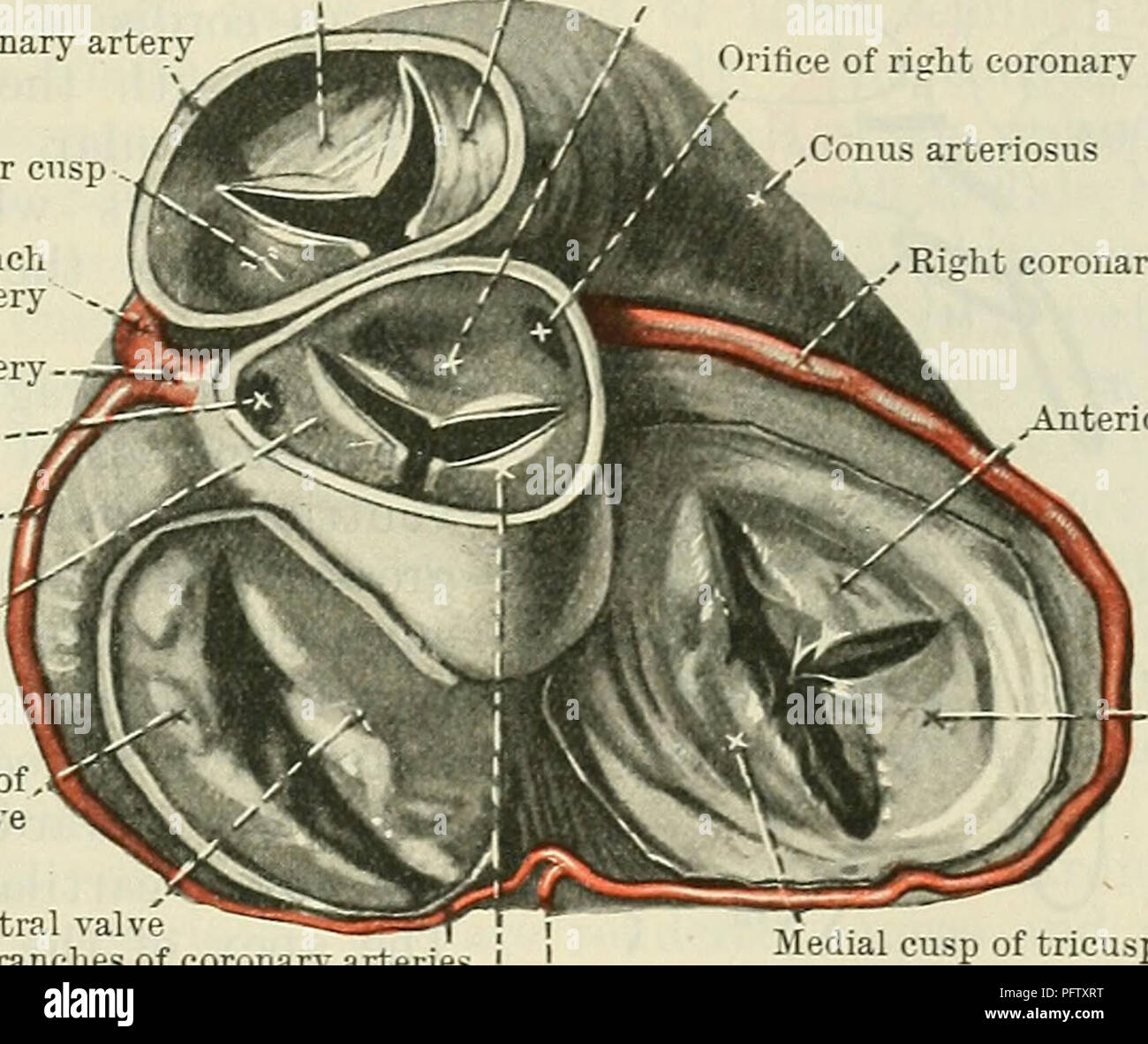 . Cunninghams Lehrbuch der Anatomie. Anatomie. Die CHAMBEES DES HEAET. 875 ist die Überreste einer Blende, das Foramen ovale, durch welche die beiden Atrien mit untereinander kommuniziert vor der Geburt. Auch in der Erwachsenen einen Teil der Öffnung im oberen Teil der Fossa in etwa einem in fünf Fällen bestehen bleibt. Zwischen den Öffnungen des superior und inferior venae cavse und posterior wird im oberen Teil der Fossa ovalis, eine kleine Eminenz kann unterschieden werden, die gerufen ist, die tuberculum intervenosum; leitet es wahrscheinlich das Blut aus der Vena cava superior die Trikuspidalklappe öffnung während Stockfoto