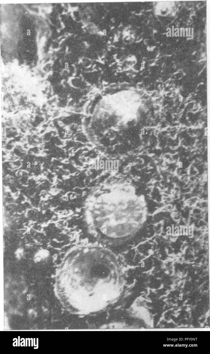 Diese umfassende Gartenbauenzyklopädie deckt verschiedene Aspekte des gewerblichen Gartenbaus ab, mit besonderem Schwerpunkt auf der Schädlingsbekämpfung und der Bekämpfung von Obstanbaumkrankheiten wie der Mehlkopflaus und dem europäischen Obst Lecanium. Stockfoto