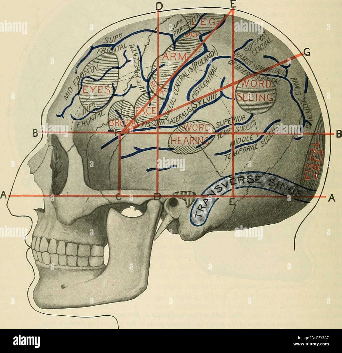 . Cunninghams Lehrbuch der Anatomie. Anatomie. 1362 SUEFACE UND SUEGICAL ANATOMIE. horizontalen Unterkieferast des lateralen zerebrale Riss, nimmt eine Ebene auf halbem Weg zwischen der IT und den zeitlichen Crest. Die vordere Horn von der Ventrikel wird gegenüber den unteren Teil des koronalen Naht, während der hintere Horn gegenüber dem hinteren Teil der zeitlichen Crest ist. Die minderwertigen Horn entspricht der zweiten zeitlichen Faltung. Die laterale Ventrikel kann getappt oder von oben abgelassen werden, durch Verfahren Hirngewebe für eine Tiefe von 4 bis 5 cm. Durch die frontale Sulcus superior, 1 in. (Zwei fino-ers" - Breite) Ich Stockfoto