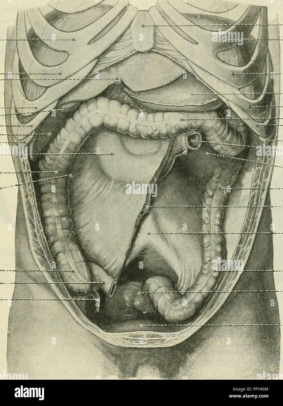 . Cunninghams Lehrbuch der Anatomie. Anatomie. OOLOK 1221 Der phrenico-koliken Ligament ist im Fötus vom linken Rand des Omentum majus gebildet (Jonnesco). Das bauchfell auf der linken Colonflexur ist ähnlich wie die der absteigende Dickdarm. Colon descendens. - Die absteigende Colon ist viel schmaler und weniger aufdringlich als die Colon ascendens: in der Tat in einer großen Anzahl von Fällen festgestellt ist fest vergeben. Es beginnt in der linken hypochondriuni auf der linken Flexur, verläuft auf der linken Seite des Bauches und endet im Lendenbereich, gegenüber dem Kamm des Ilium, von Pass Stockfoto