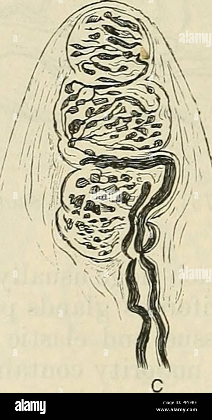 . Cunninghams Lehrbuch der Anatomie. Anatomie. Abb. 735.-taktile Blutkörperchen. A, Ende der Lampe (Krause). B, korpuskel von pacini 1. ", . , C, korpuskel von Meissner/(nach ranvier) - ANHANGSGEBILDE der Haut. Die ANHANGSGEBILDE der Haut, der Nägel, der Haare, der Talgdrüsen, und der sudoriferous oder Drüsen schwitzen. Ungues. - die Nägel (Abbn. 736, 737) sind epidermalen Strukturen, und die Hufe und Klauen der niederen Tieren dar. Die Wurzel der Nagel ist versteckt. Bitte beachten Sie, dass diese Bilder aus gescannten Seite Bilder, die digital für die Lesbarkeit erhöht worden sein können extrahiert werden - Färbung Stockfoto