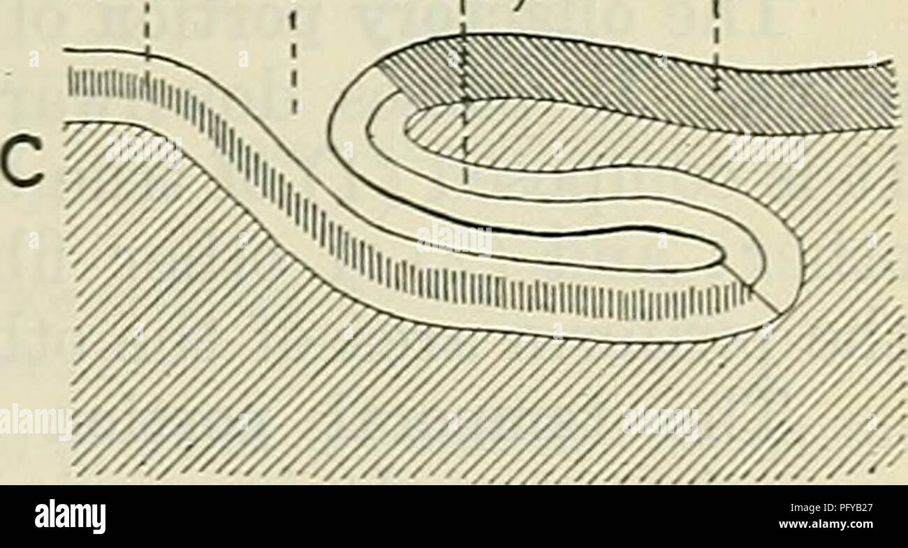 . Cunninghams Lehrbuch der Anatomie. Anatomie. Abb. 575.- Diagramme drei Arten der zerebralen Furrotvs zu erklären. Der frontalen Pole, während die meisten auskragenden Teil des posterioren Ende ist der Okzipitalen Pol bezeichnet. Auf der Oberfläche der Halbkugel der markante Punkt der zerebralen Stoff, erstreckt sich nach vorne unterhalb der seitlichen Spalte erhält den Namen des zeitlichen Pole. In einer gut-gehärtete Gehirn eine breite Nut in der Regel auf der medialen und minderwertigen Aspekt des Okzipitalen Pol der rechten Hemisphäre vorhanden ist. Dies entspricht der zu Beginn des rechten Quer venösen Sinus. Ein Stockfoto