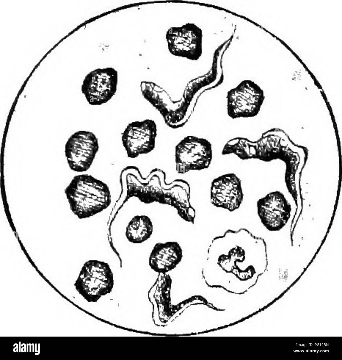 . Klinische Diagnostik der inneren Krankheiten der Haustiere. Veterinärmedizin; Diagnose, Veterinär; Veterinärmedizin. Das Blut. 251 Der Durchmesser eines roten Blutkörperchen. Die konvex Grenze der Körper enthält eine feine Membran, erstreckt sich bis zum Ende der Körper, bilden einen Schwanz. Der Körper des Parasiten enthält helle runde Körnchen, die nicht der Fleck. Sehr destruc in Südamerika. Abb. 57.. Nagana, Tsetse Krankheit, Surra. Tritt bei Rindern, solidungula, Kamele, Hunde und Katzen. Hierbei handelt es sich um eine perniziöse Anämie verursacht durch dem Namen Trypanosoma evansi (in die eingeführt Stockfoto