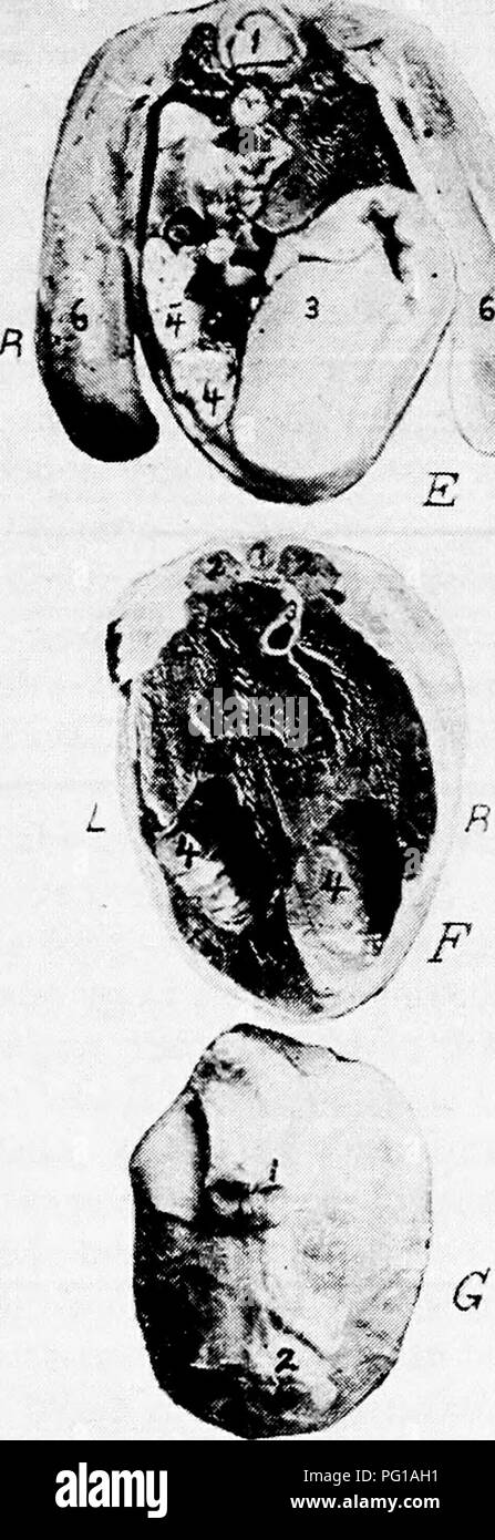 . Die Anatomie der Haushühner. Heimische Tiere; Veterinärmedizin; Geflügel. SPLANCHNOLOGY 167 Cles. Dies ist eine Ansicht freuen. Abbildung 48, C, ist ein Blick auf den hinteren Abschnitt am Bild gemacht. 47, C. Es zeigt die gleichen Beziehungen der Speiseröhre, Lunge, zeigt aber auf dieser Ebene sowohl das Recht als auch. Schwein. 49.- Querschnitt durch den Körper eines Babys, das Küken. E Bei E, Abb. SO. Ich, Rückenmark. ;:, Nieren. 3, Geflügelmagen. 4, Darm. S, nicht resorbierte Eigelb. 6, Stubs der Beine. F. eine Abschnitt atF, Abb. 50. Ich, Rückenmark. 2, Nieren. 3, Darm. 4. Nicht resorbiertem Eigelb. G. in G, Abb. 50. Ich Stockfoto