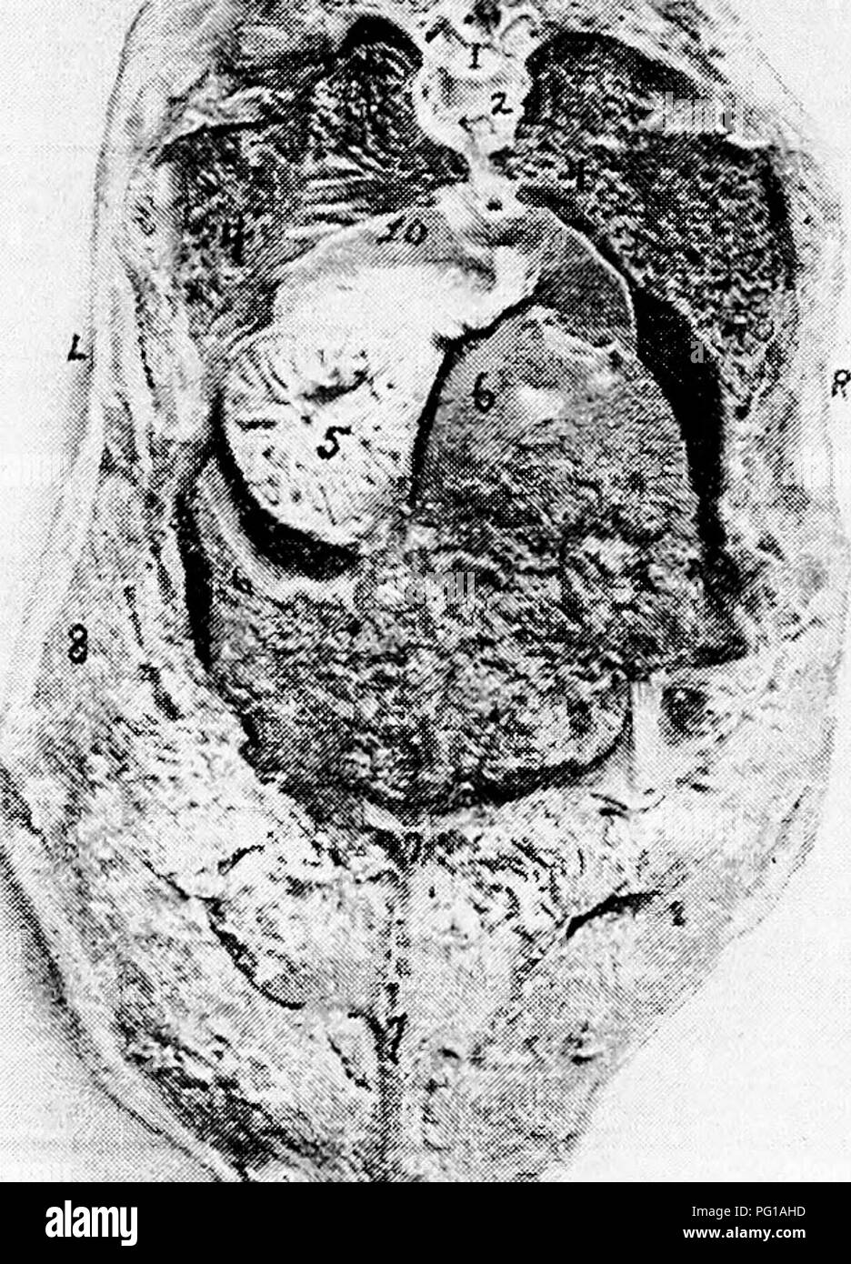 Stich Mundhöhle Nasenhöhlen Kehlkopf Oberkiefer Kinn Speiseröhre 1890 Original