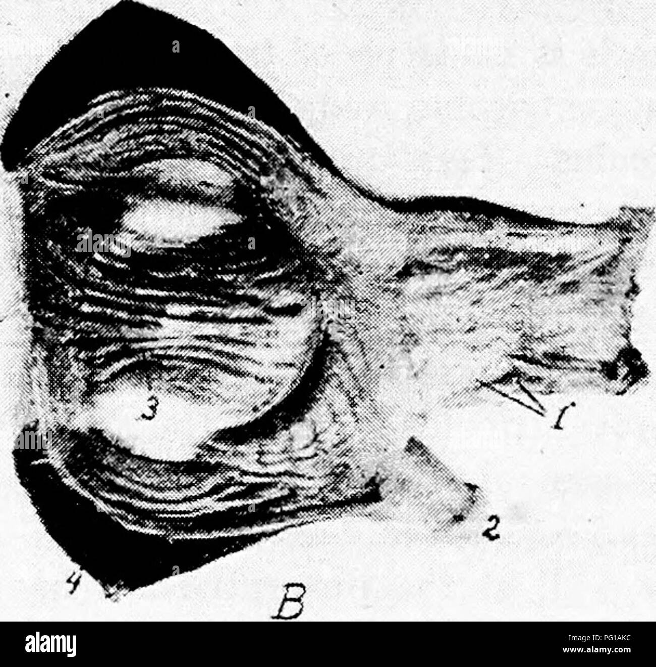 . Die Anatomie der Haushühner. Heimische Tiere; Veterinärmedizin; Geflügel. Abb. 32.- Muskelmagen und stomacli der Vögel. A. ICH, alveoläre Drüsen. 2, Schleimhaut der inneren Oberfläche der pro-ventriculus zeigt die tubuläre Drüsen. 3, Bindegewebe zwischen der alveoläre Drüsen. 4, eine Arterie. 5, Muscularis mucosae. B. Foto des proventriculus und Muskelmagen, i, Proventriculus übersicht Stomata der Drüsen. ^, Ende der Zwölffingerdarm. 3, Muskelmagen, hornified epithe - Lium in Rillen gebildet. 4, die schweren muskulösen Wände.. Bitte beachten Sie, dass diese Bilder aus gescannten Seite im extrahiert werden Stockfoto
