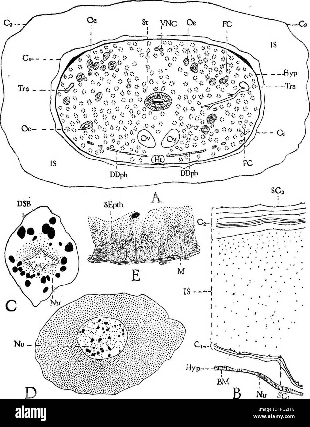 Dieses Bild zeigt die Gewebestruktur einer Arbeiterbienenlarve, die von der Sacbroodenerkrankung betroffen ist, und zeigt die Veränderungen im Bauch, wenn die Larve stirbt. Sacbrood ist eine Virusinfektion, die Honigbienenlarven beeinflußt und zu Gewebeabbau und Tod führt. Stockfoto