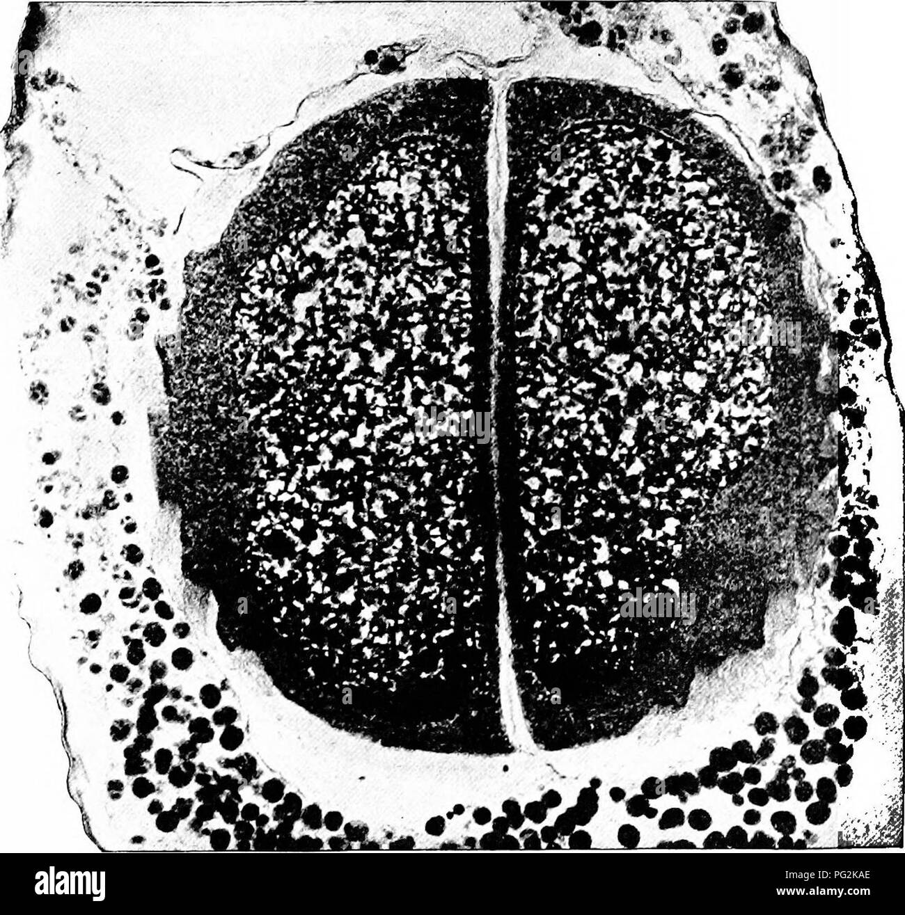 . Morphologie der gymnosperms. Gymnosperms; Pflanze Morphologie. 146 MORPHOLOGIE DER GYMNOSPERMS brane, konnte aber nicht feststellen, ob es für die Spermien gehörten oder vielleicht nur die Hautschicht des Zytoplasma der Pollen. In einem solchen Fall die beiden spermien würde einfach vom Stiel zelle gelöst werden und Sie Schwimmen (Abbn. 170-175). In Dioon edule, Chamberlain (63), die Aufteilung der Körperzelle entsteht. Abb. 173.- Dioon edule: photomicrograph am Ende der Pollen Rohr, die zeigen, dass die zwei Spermien innerhalb von Samenzellen Mutter Zellen gebildet werden; die Wände der Mutter Zellen gesehen werden kann b Stockfoto