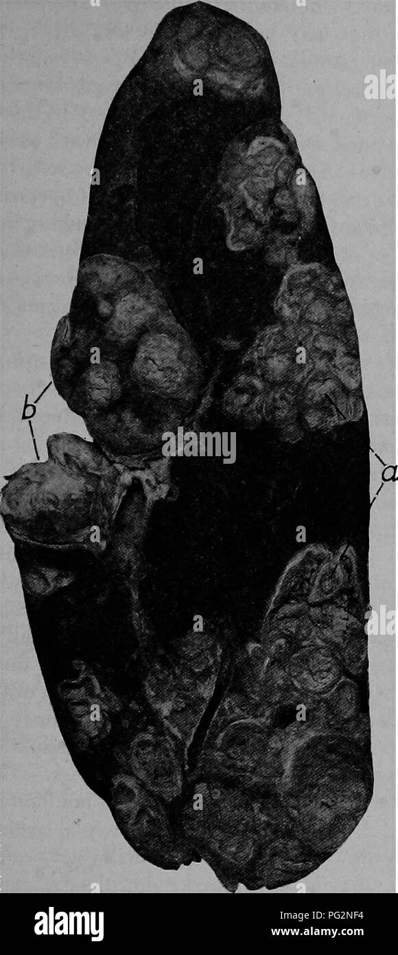 . Die Pathologie und differenzierte Diagnose von Infektionskrankheiten der Tiere: für Studierende und Praktiker der Veterinärmedizin vorbereitet. Veterinärmedizin; übertragbaren Krankheiten bei Tieren. Tuberkulose 165. Abb. 37. Ein Foto von einer choss Abschnitt durch das Portal von einer Knolle - culotts Leber einer Kuh. Es zeigt einige der tuberkulösen Massen (a) Innerhalb der Leber. In einigen dieser das tote Gewebe ist Anfang calcift. Die portal-Verschraubung (B) vert wesentlich vergrößert und der Tuberkulösen, (verkleinert). Im Falle von Geflügel die Bakterien sind in der Regel in sehr großen nu Stockfoto