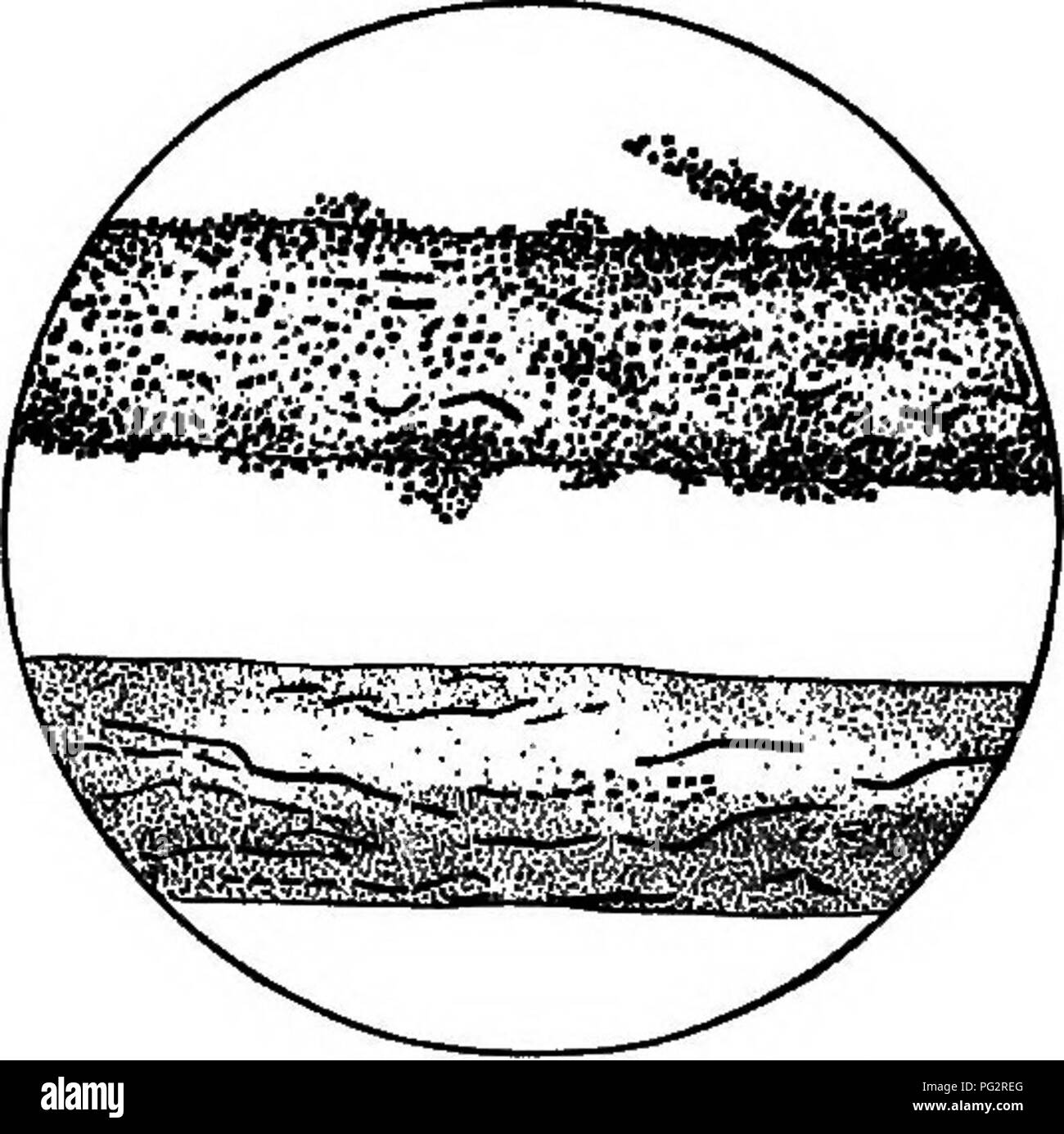 . Bakterien, Hefen und Schimmelpilze in der Wohnung. Bakteriologie; Hefepilze; Formen (Pilze). Abb. 28. Eine Form (TRICHOPHYTON), die Flechte produziert. Bei o ist ein wenig Haar mit dem Schimmel, Sporen auf der Außenseite und an ^ eine Abbildung der Form selbst hoch vergrößert. Namen. Die Zuneigung ist eine lästige zu heilen, vor allem, wenn es in die Kopfhaut bekommt; es kann sich kahle Stellen erzeugen, aber ist nie sehr ernst. Zwei oder drei Arten von dieser Krankheit sind gefunden worden, die durch zwei oder drei Arten von Formen hergestellt werden. Abb. 28 zeigt eine der häufigsten Arten, die Ursache der Flechte. Bei A ist ein wenig Haar mit gezeigt Stockfoto