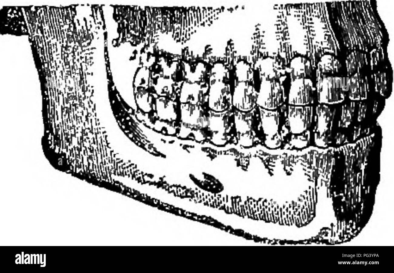 . Elementare Biologie, Tier und Mensch. Biologie. Die VERDAUUNG UND ABSORPTION VON NUTBIJENTS 87 Prüfen Sie sorgfältig die einzelnen Zähne im Mund, und geben Sie in einer Tabelle wie folgt die Anzahl der Kavitäten (ungefüllt) und der Anzahl der Füllungen, die Sie finden. Rechte Hälfte op Oberkiefer linke Hälfte op Uppeb Kiefer die rechte Hälfte des Unterkiefers linke Hälfte der Unterkiefer Füll Füll Hohlraum Hohlraum Befüllen FUling Schneidezähne. Die Eckzähne. Bicuspids Molaren. .. 116. Anordnung der Zähne. - Innerhalb der Mundhöhle die feste Nahrung in kleine Stücke geschnitten, gemischt mit den Säften der Mund, und dann g Stockfoto