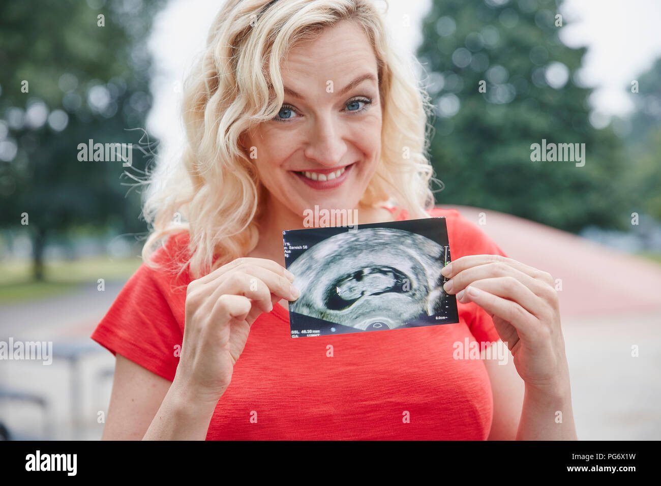 Portrait von glücklich schwanger Frau mit Ultraschall Bild im Freien Stockfoto