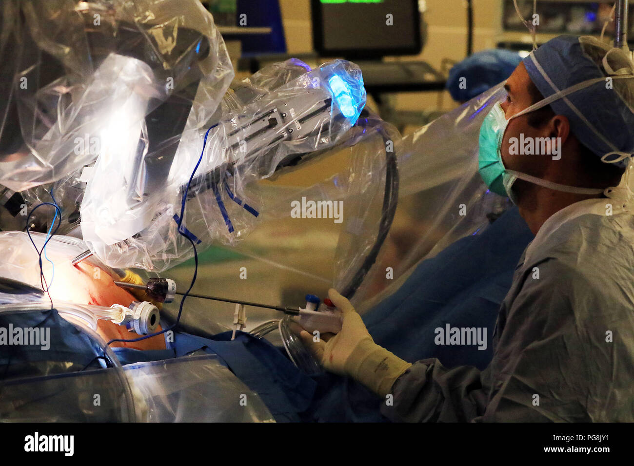 August 24, 2018 - Davenport, Iowa, USA - Timothy Paul Kresowik, MD von urologischen Teilnehmern Vorlagen während des Verfahrens durch das Auswechseln der Werkzeuge auf die Roboterarme und das Absaugen von Flüssigkeiten aus dem Bauch während der Chirurgie. (Bild: © Kevin E. Schmidt/Viererkabel - Zeiten/Viererkabel - Zeiten über ZUMA Draht) Stockfoto