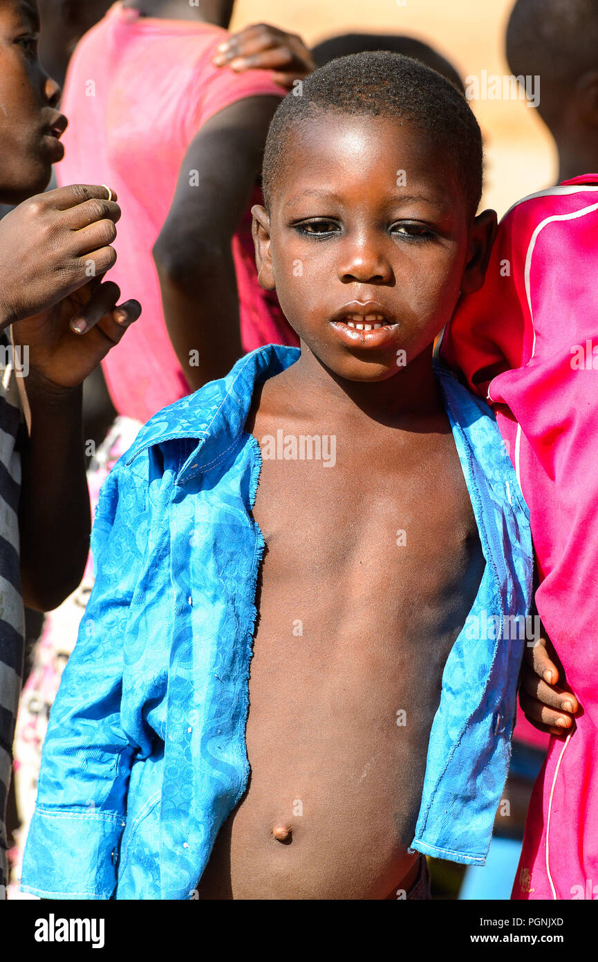 KARA REG., TOGO - Jan 14, 2017: Unbekannter Konkomba kleiner Junge im blauen Hemd öffnet den Mund, im Dorf. Konkombas sind ethnische Gruppe von Togo Stockfoto