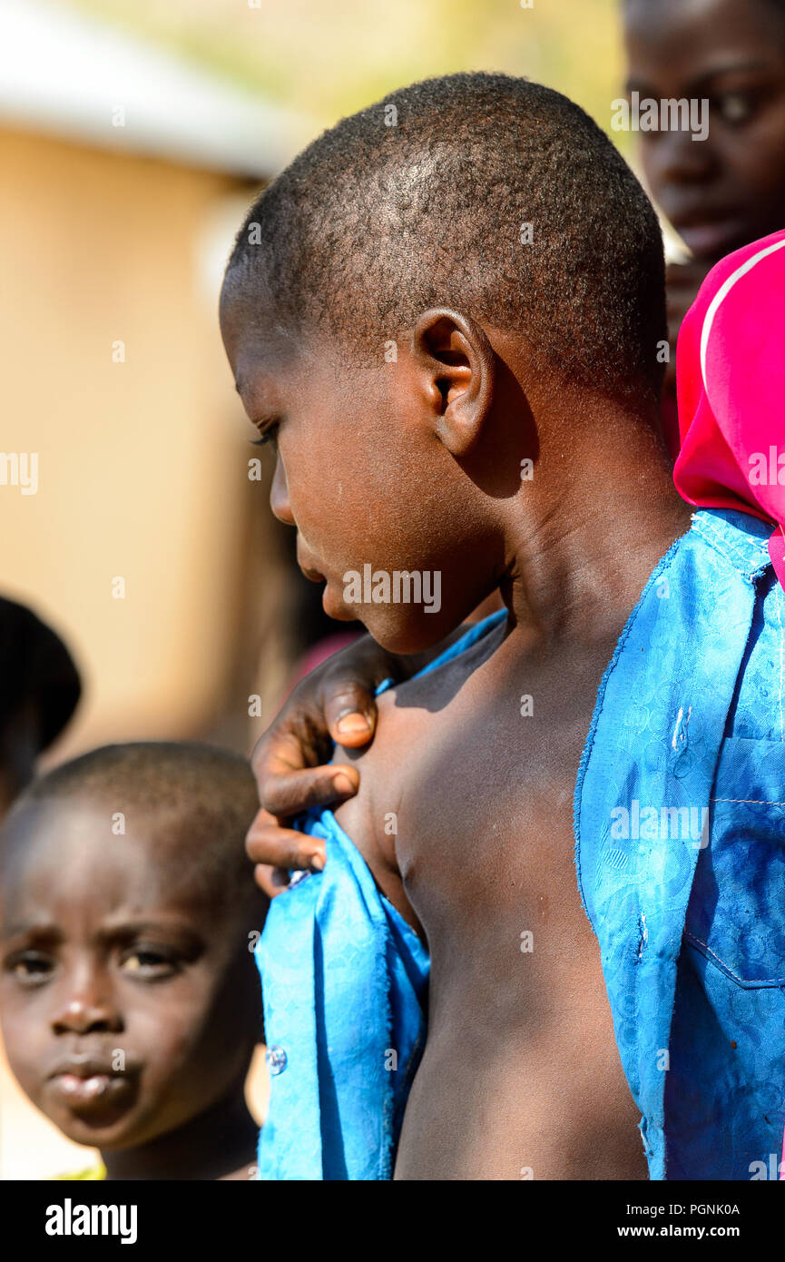 KARA REG., TOGO - Jan 14, 2017: Unbekannter Konkomba kleiner Junge im blauen Hemd sieht hinunter in das Dorf. Konkombas sind ethnische Gruppe von Togo Stockfoto