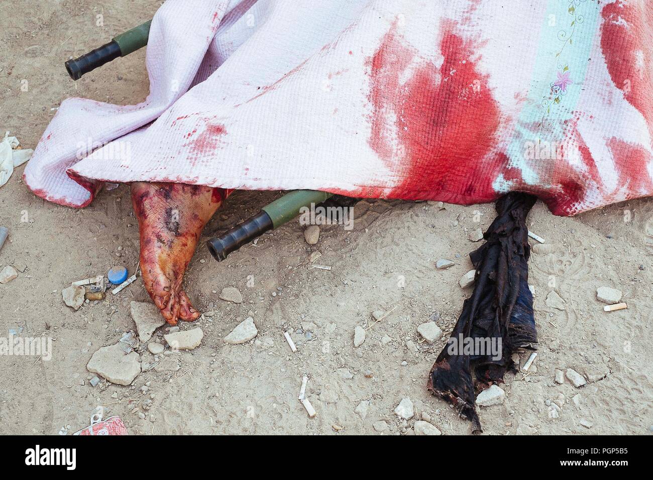 Das Krankenhaus von Gagjali, einem Vorort von Mossul (IQ), während der Offensive gegen ISIS. Der Fuß eines Toten mit Blut im Krankenhaus behandelt. Gajali Stockfoto