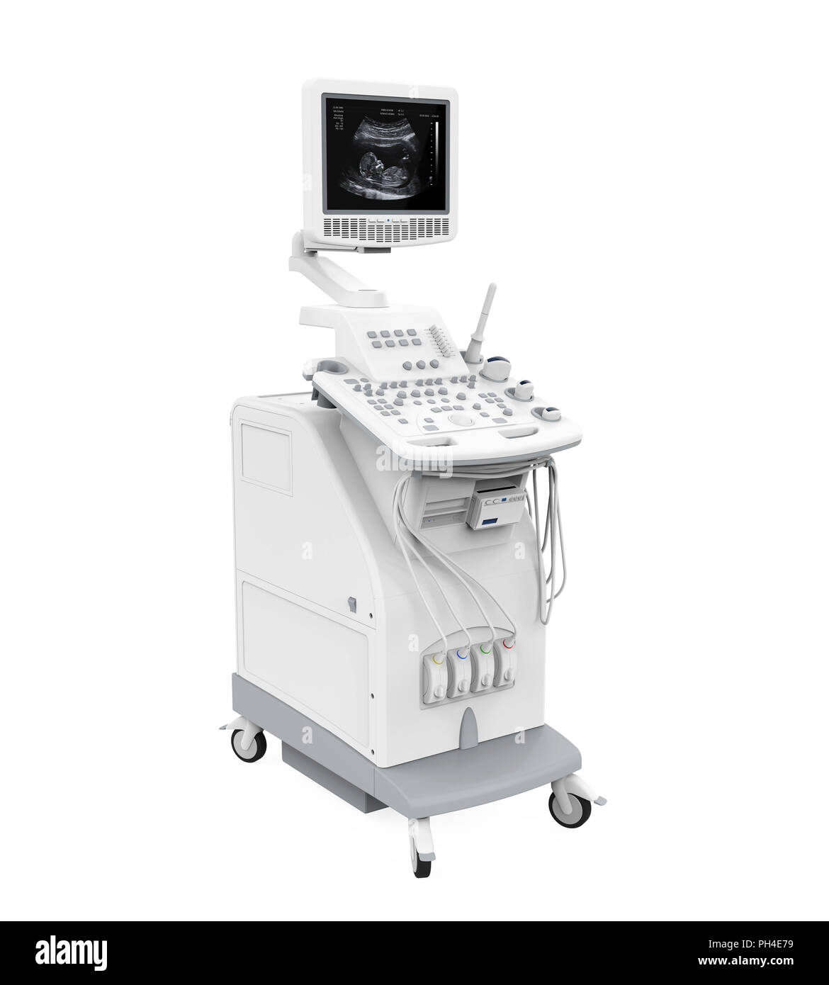 Medizinischen Ultraschall Diagnose Maschine isoliert Stockfoto