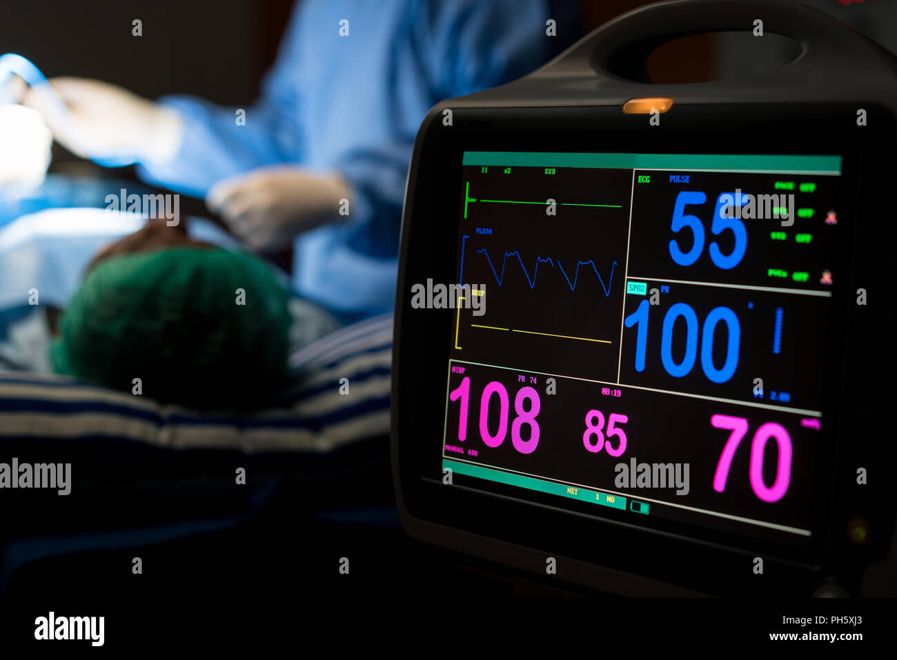 Elektrokardiogramm im Krankenhaus Chirurgie operative Notaufnahme, die Herzfrequenz des Patienten mit blur Team von Chirurgen in den Hintergrund. Gesundheit und Medizin Stockfoto