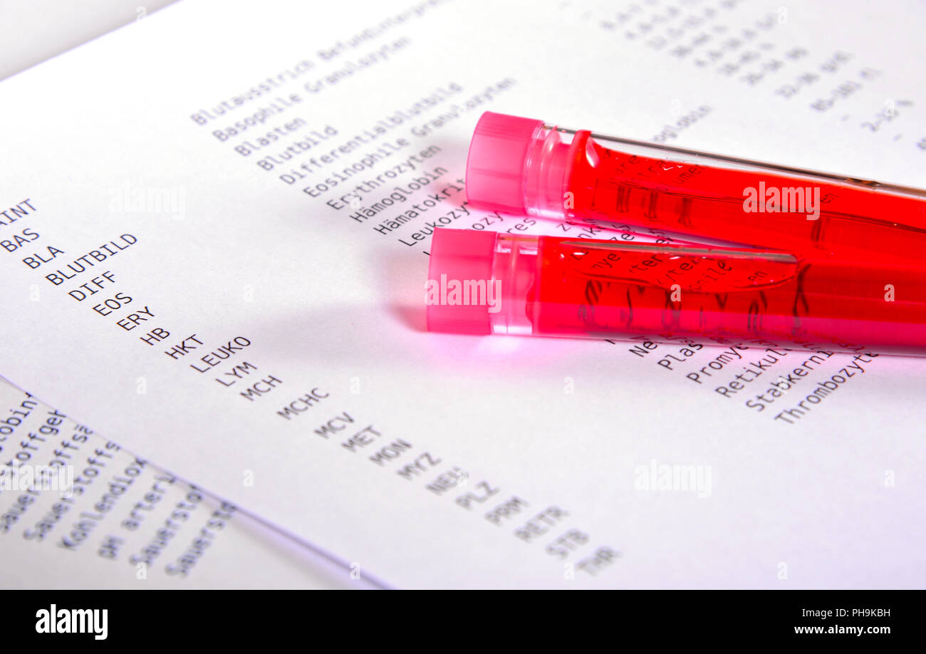 Lab Blutprobe Labor Medizin Stockfoto