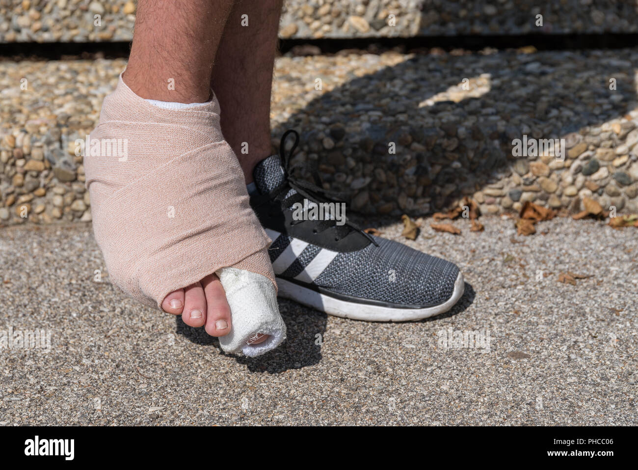 Bandagierten rechten Fuß und Zehen Schädigung - close-up Stockfoto