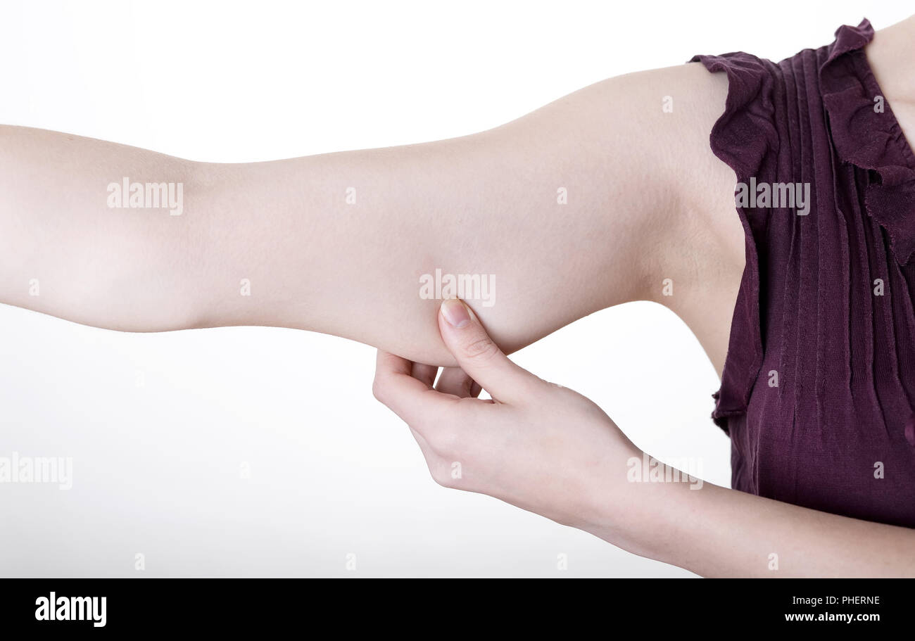 Womans Hand kneifen im oberen Arm Stockfoto