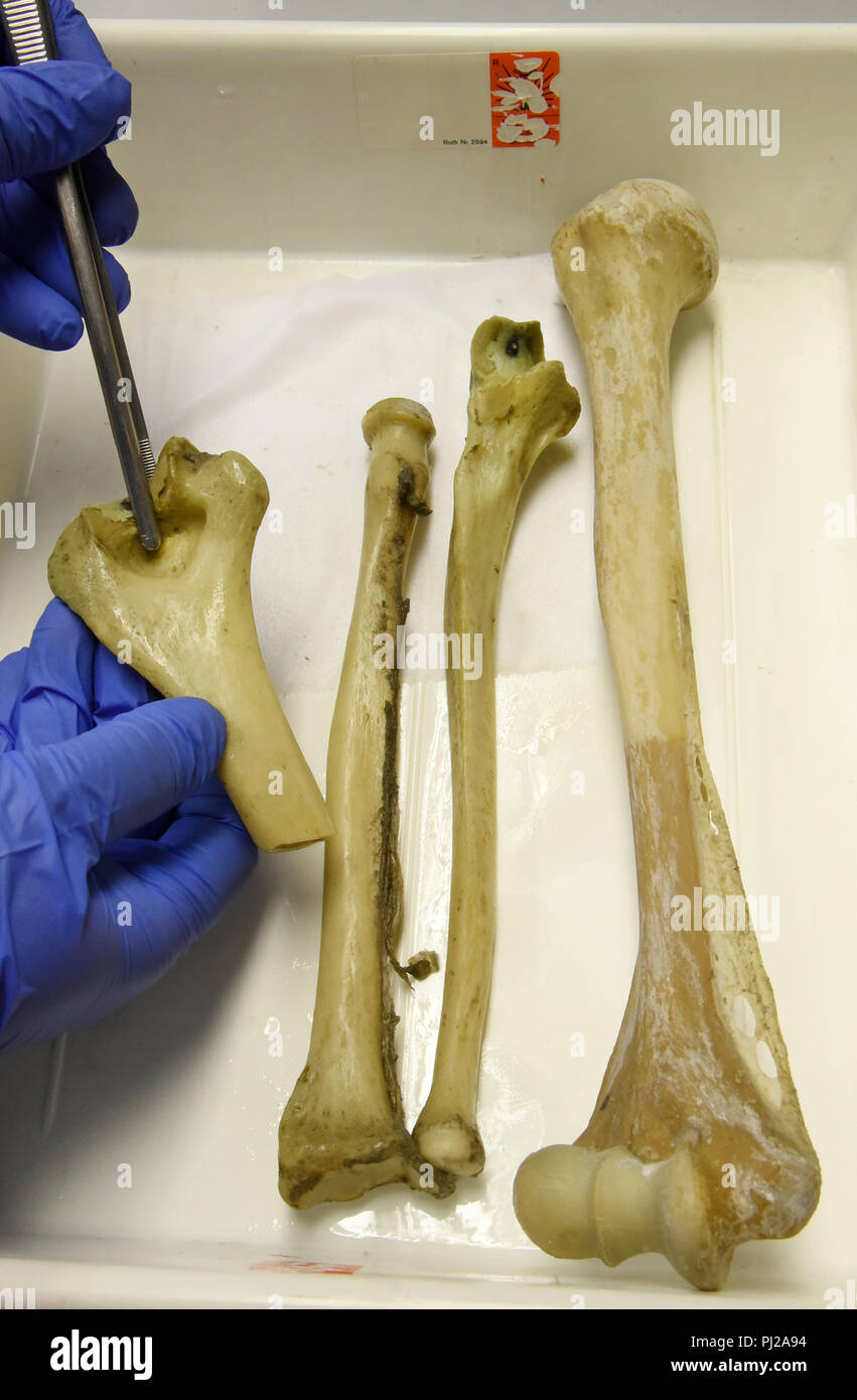 03.09.2018, Sachsen-Anhalt, Halle/Saale: In ihrem Labor in der meckels Sammlungen des Instituts für Anatomie und Zellbiologie der Martin-Luther-Universität Halle-Wittenberg, Julia Hallasch Orte über 100 Jahre alten oberen und unteren Arm Knochen aus einer Erhaltung Glas in eine Schüssel geben. Die Vorbereitung gehört zu mehreren hundert Sammlung Stücke aus dem 18. Jahrhundert, die derzeit gewässert werden, nachdem sie entfernt wurden und in gereinigte Gläser mit 70% Alkohol gefüllt und mit neuen Etiketten. Die Lehre und Forschung Sammlung, die rund 8000 Exemplare von Mensch und Tier war, establi Stockfoto
