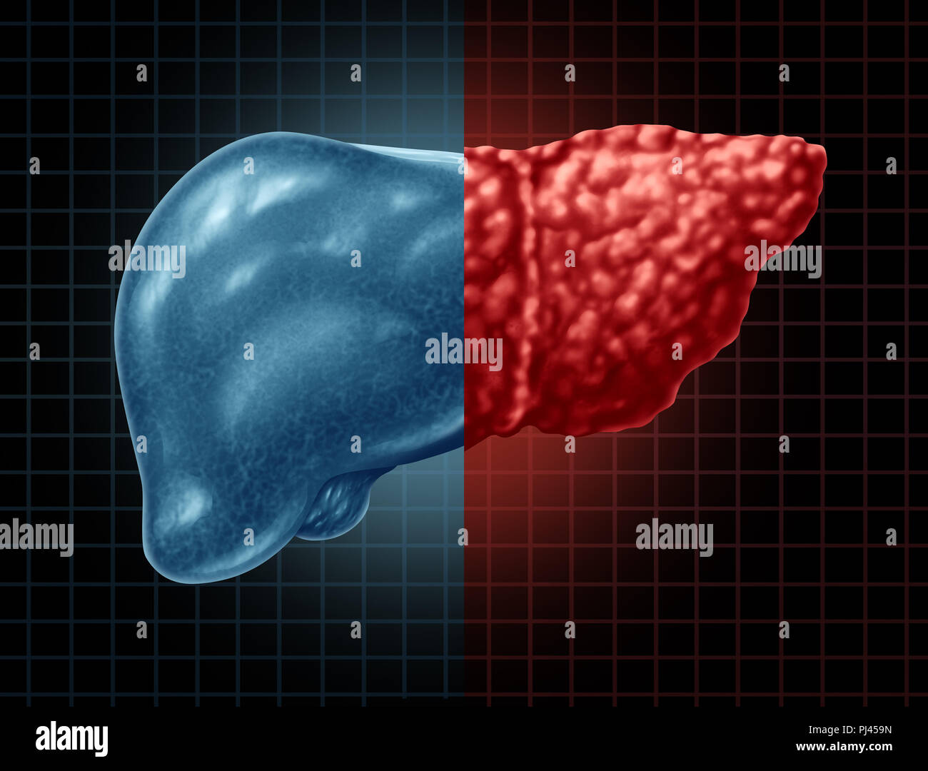 Fettsäuren eine Lebererkrankung und eine Hepatosteatose Körperteil als Medical Health Care Konzept des Verdauungssystems Anatomie und lebenswichtige Organ für die Verdauung. Stockfoto